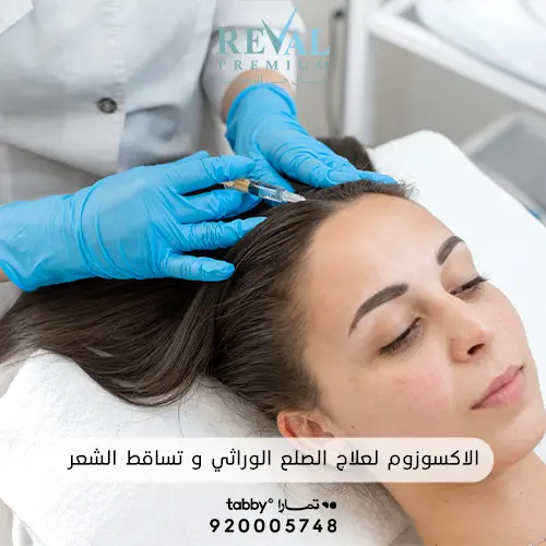 فوائد ابر الأكسوزوم لعلاج الصلع الوراثي