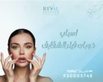 أسباب ذوبان فيلر الشفايف بسرعة: كيف أحافظ على حقن الفيلر للشفايف مدة أطول؟