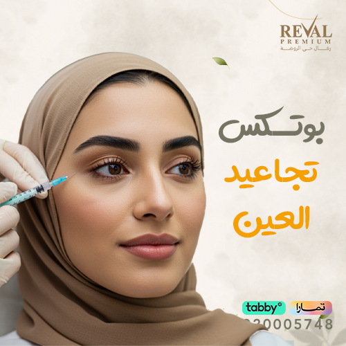 متى تظهر نتائج بوتوكس تجاعيد العين؟