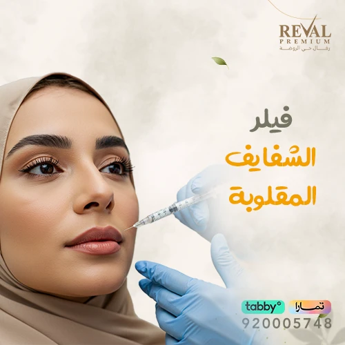 متى تظهر نتيجة حقن فيلر الشفايف المقلوبة؟