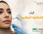 اسرار فيلر الشفايف المقلوبة تعرف عليها قبل حقن فيلر الشفاه الروسية😉