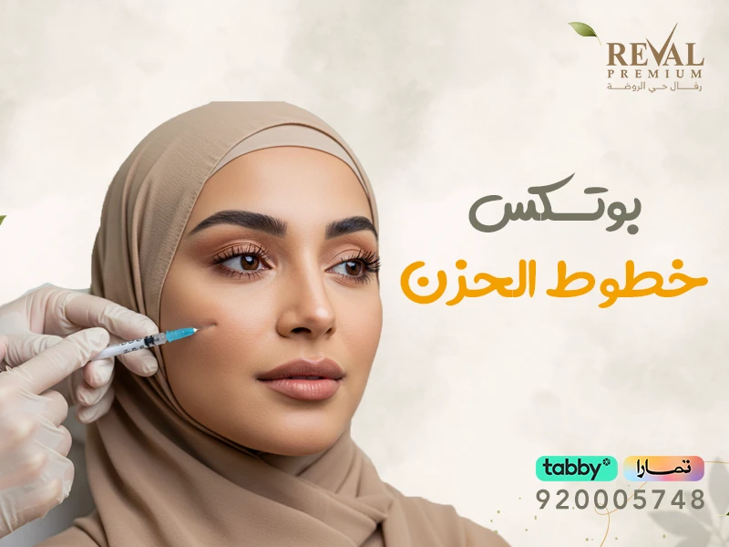 بوتكس خطوط الحزن: دليل شامل لعلاج الابتسامة الحزينة ورفع ملامح الوجه