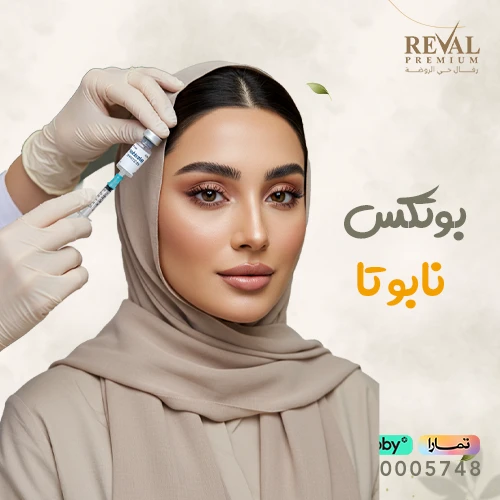 بوتكس نابوتا قبل وبعد