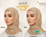 تكساس تحديد الفك: تجربتي مع ابر التكساس