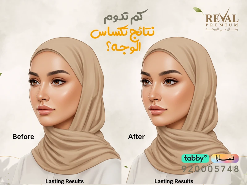 تكساس تحديد الفك: تجربتي مع ابر التكساس