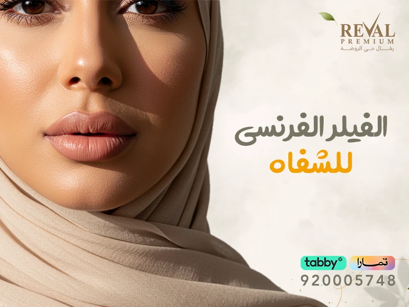 الفيلر الفرنسي للشفاه