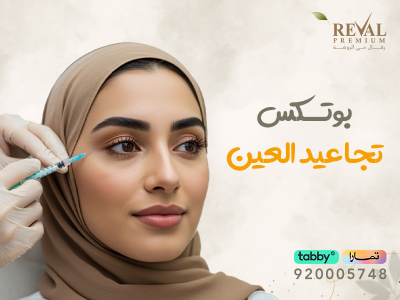 بوتكس تجاعيد العين: افضل اسعار بوتوكس العين بالرياض