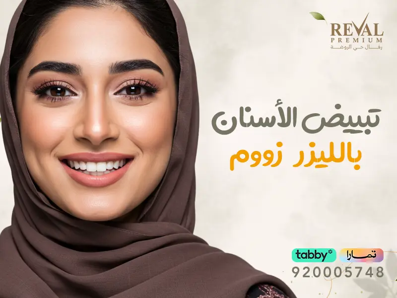 تبييض الأسنان بالليزر زووم (Zoom Whitening)