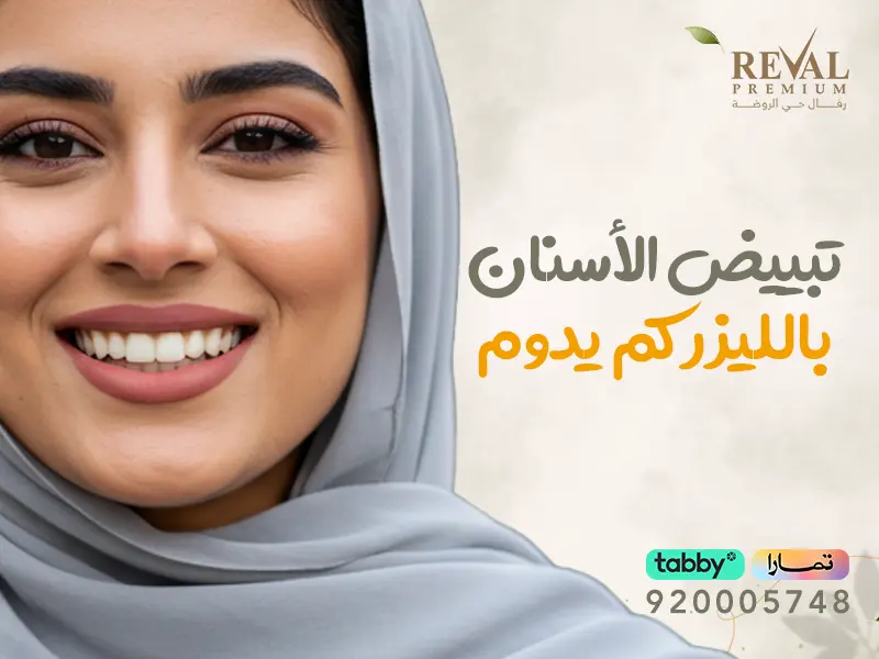 تبييض الأسنان بالليزر كم يدوم⁉ تجنب 5 أخطاء شائعة بعد التبييض تقلل من مدة النتائج