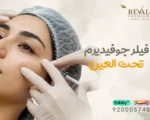 فيلر جوفيديرم تحت العين: الحل الحديث لعلاج الهالات السوداء والتجاعيد الدقيقة بالرياض