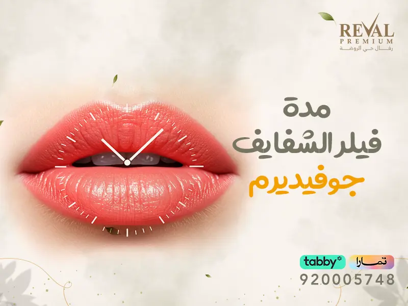 مدة فيلر الشفايف جوفيديرم: متى تظهر النتائج وكم تدوم⁉ تعليمات بعد حقن فيلر الشفاه