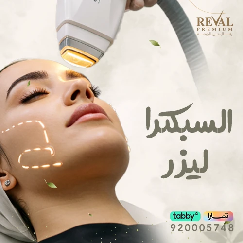 تجربتي مع السبكترا ليزر