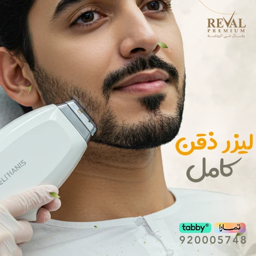 تجربتي مع ليزر ذقن كامل