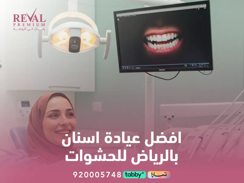 أفضل عيادة أسنان بالرياض للحشوات
