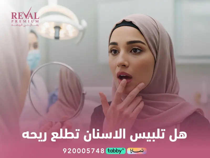تجربتي مع تلبيس الأسنان