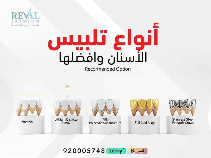 تجربتي مع تركيبات الأسنان