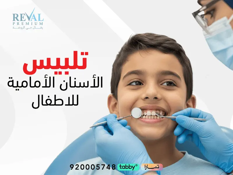 تلبيس الأسنان الأمامية للأطفال: الأنواع، المميزات، العيوب، وطريقة التركيب خطوة بخطوة