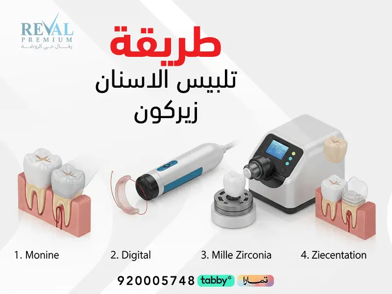طريقة تلبيس الأسنان زيركون: الخطوات والمميزات والعيوب وكيف أعرف أسنان الزيركون الأصلي؟