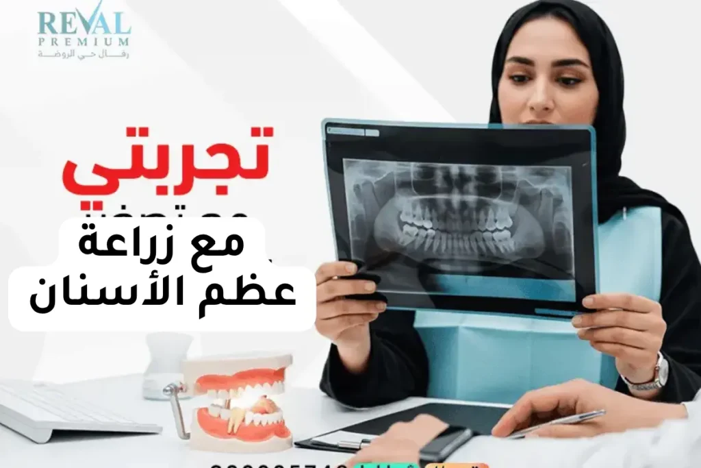 نصائح قبل وبعد زراعة عظم الفك بالرياض
