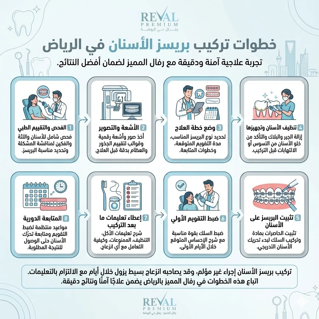 خطوات تركيب بريسز الأسنان في الرياض