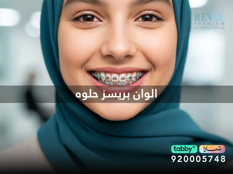 الوان بريسز حلوه | كيفية اختيار أجمل وأرقى ألوان تقويم الأسنان