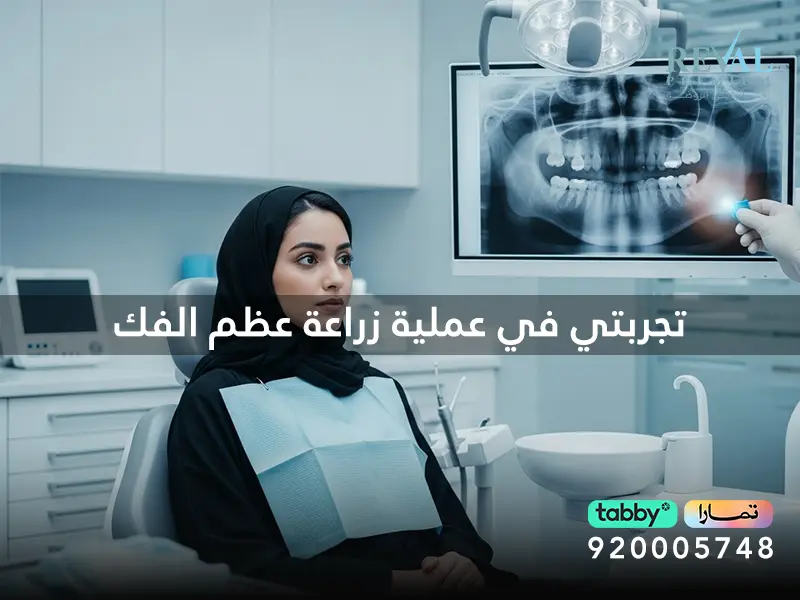 ما هي الحالات التي تستدعي زراعة عظم في الفك؟ تجربتي في عملية زراعة عظم الفك