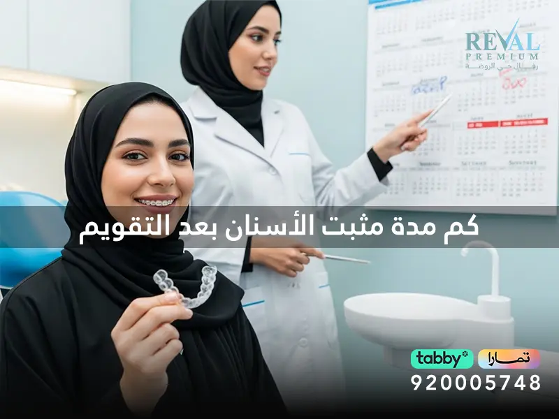 كم مدة مثبت الأسنان بعد التقويم لابتسامة تدوم مدى الحياة؟ متى يتم إزالة مثبت التقويم؟
