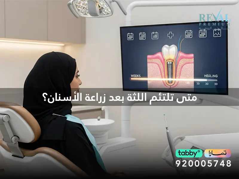 متى تلتئم اللثة بعد زراعة الأسنان؟ هل التهاب اللثة من مشاكل زراعة الأسنان؟