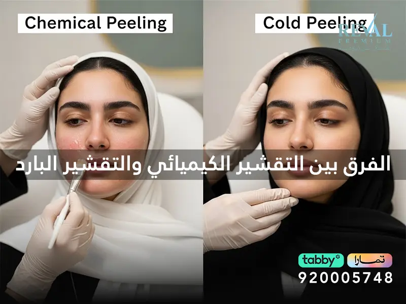 الفرق بين التقشير الكيميائي والتقشير البارد