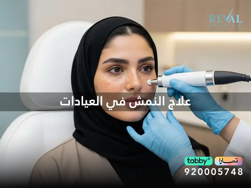 افضل طرق علاج النمش في العيادات