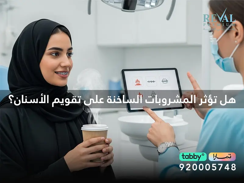 ما هي الممنوعات أثناء التقويم