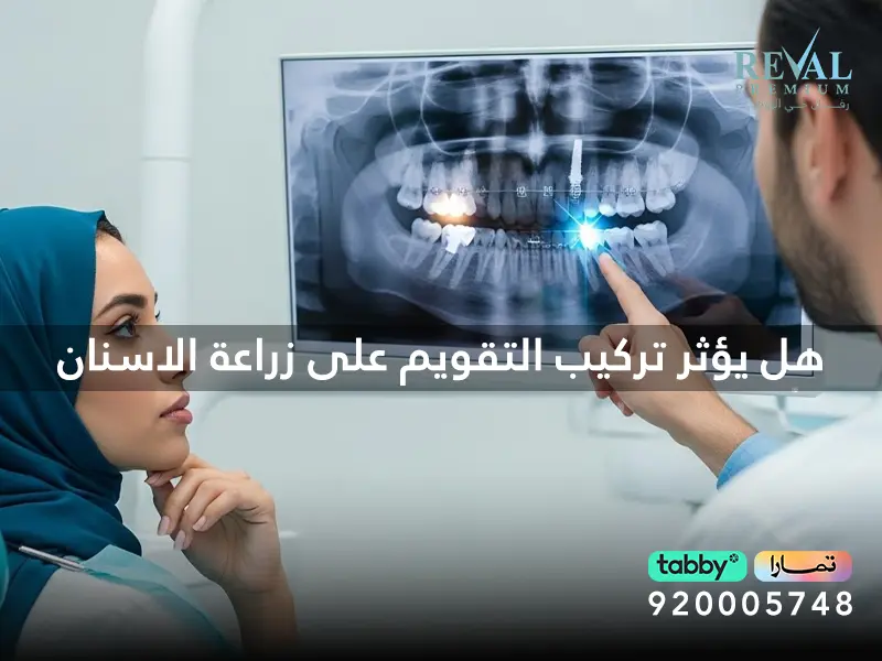 تجربتي مع الجمع بين التقويم والزراعة