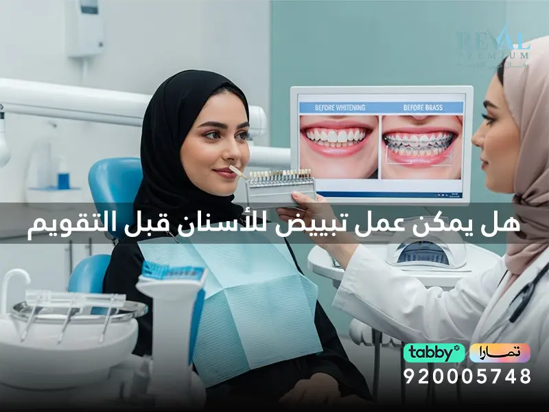 تجربتي مع التقويم والتبييض