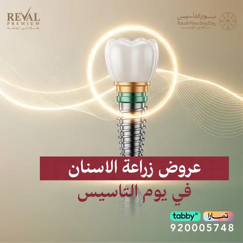 احدث عروض رمضان على  زراعة الأسنان