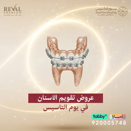 عروض تقويم الاسنان في يوم التاسيس
