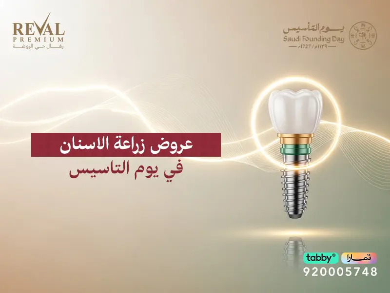 عروض زراعة الأسنان في يوم التأسيس: فرصتك الذهبية لابتسامة تليق بك